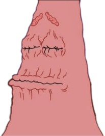 dry_patrick Emoji