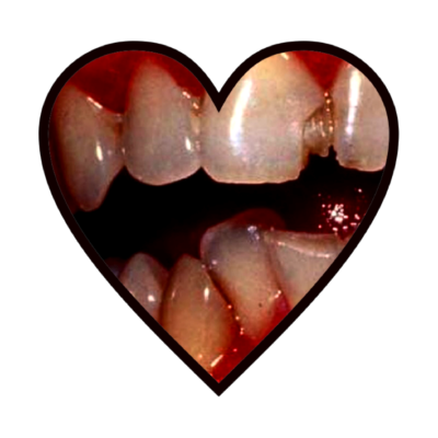 Teeth Emoji